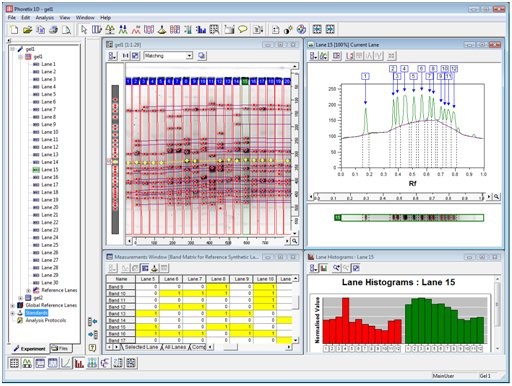 [DH.WGD00121] Gel documentation system Software Phoretix 1D Pro
